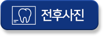 전후사진